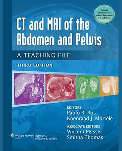 CT & MRI of the Abdomen and Pelvis