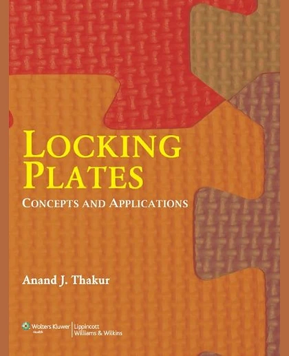 Locking Plates: Concepts and Applications