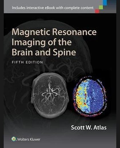 Magnetic Resonance Imaging of the Brain and Spine