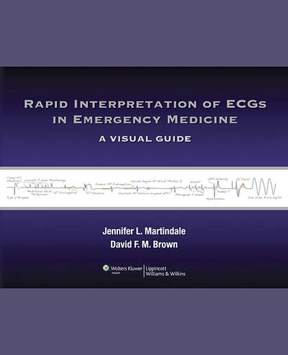 Rapid Interpretation of ECGs in Emergency Medicine: A Visual Guide