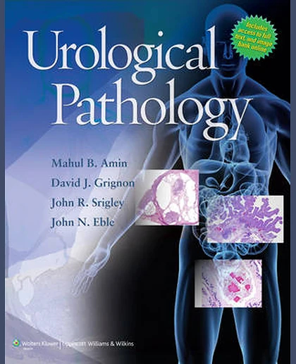 Urological Pathology