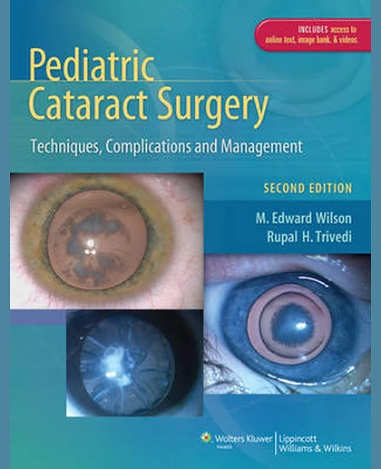 Pediatric Cataract Surgery: Techniques, Complications and Management