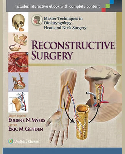 Master Techniques in Otolaryngology - Head and Neck Surgery: Reconstructive Surgery