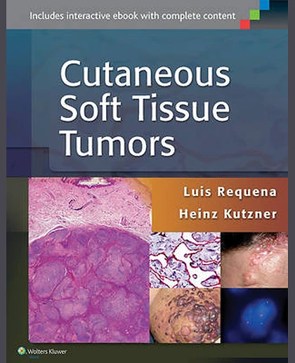 Cutaneous Soft Tissue Tumors