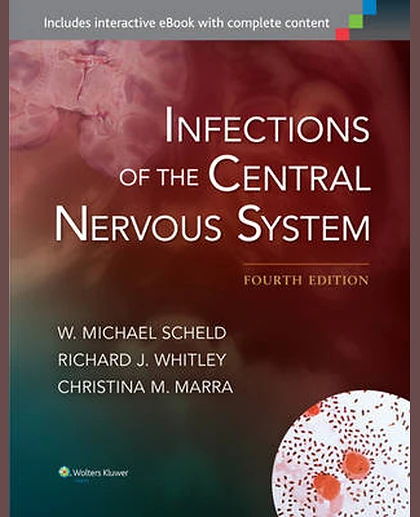 Infections of the Central Nervous System