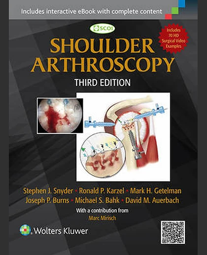 Shoulder Arthroscopy