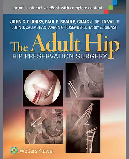 The Adult Hip: Hip Preservation Surgery