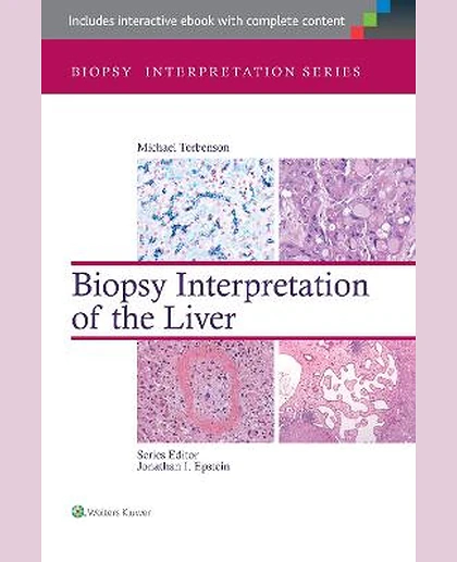 Biopsy Interpretation of the Liver