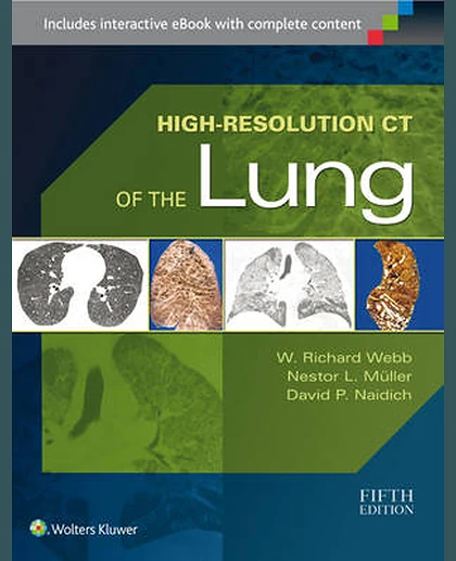 High-Resolution CT of the Lung