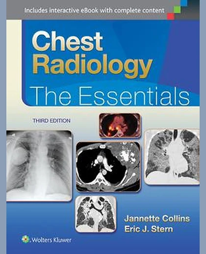 Chest Radiology: The Essentials