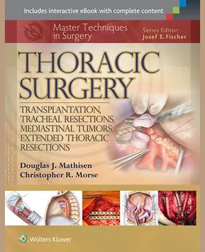 Master Techniques in Surgery: Thoracic Surgery: Transplantation, Tracheal Resections, Mediastinal Tumors, Extended Thoracic Resections