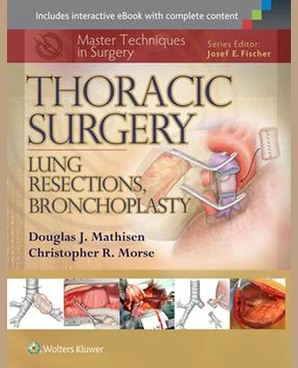 Master Techniques in Surgery: Thoracic Surgery: Lung Resections, Bronchoplasty