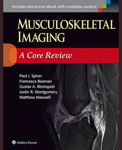 Musculoskeletal Imaging: A Core Review