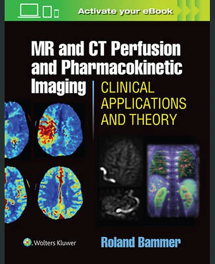 MR and CT Perfusion and Pharmacokinetic Imaging: Clinical Applications and Theoretical Principles