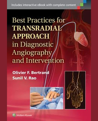 Best Practices for Transradial Approach in Diagnostic Angiography and Intervention