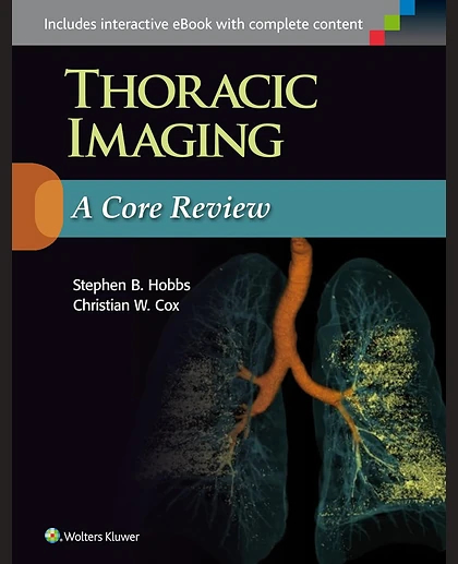Thoracic Radiology: A Core Review