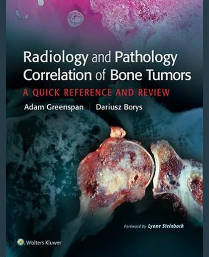 Radiology and Pathology Correlation of Bone Tumors