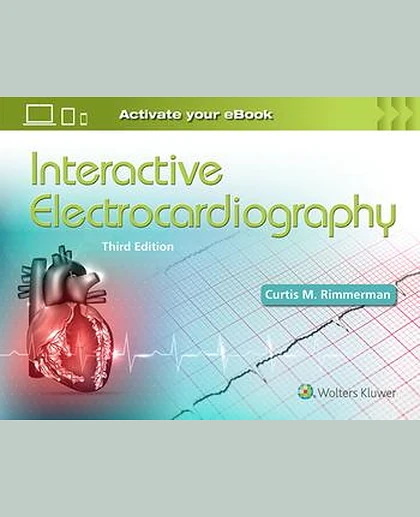 Interactive Electrocardiography