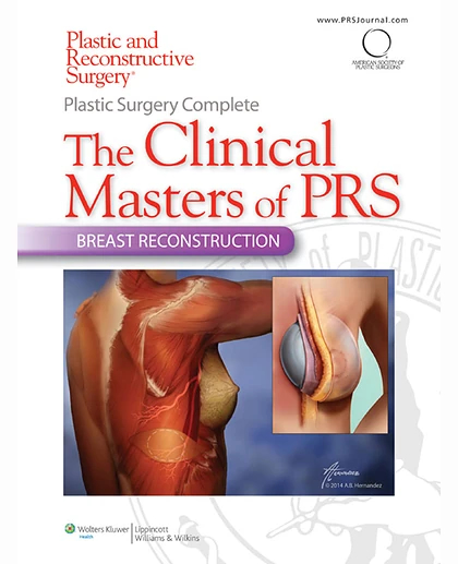 Plastic Surgery Complete: The Clinical Masters of PRS- Breast Reconstruction