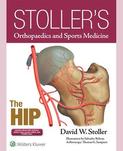 Stoller's Orthopaedics and Sports Medicine: The Hip