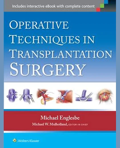 Operative Techniques in Transplantation Surgery