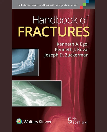 Handbook of Fractures