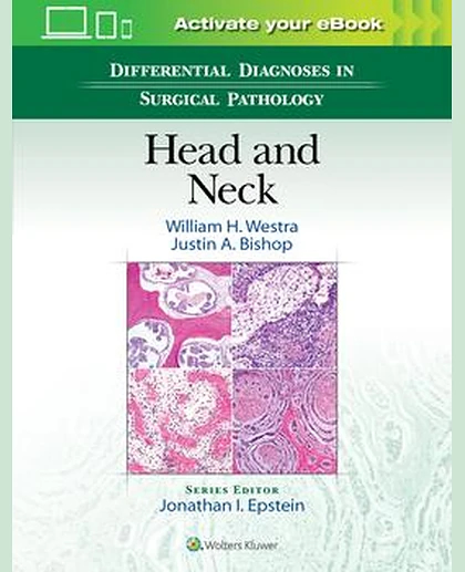 Differential Diagnoses in Surgical Pathology: Head and Neck