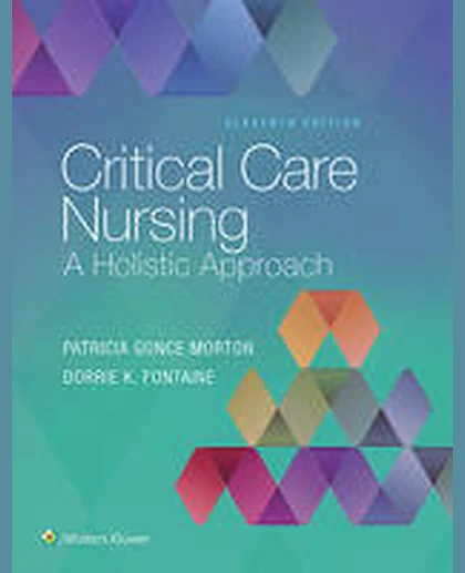 Critical Care Nursing: A Holistic Approach