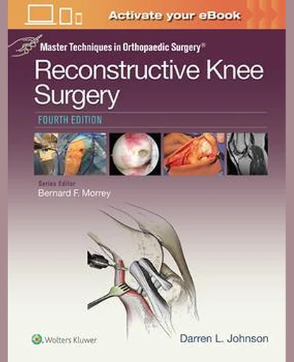 Master Techniques in Orthopaedic Surgery: Reconstructive Knee Surgery
