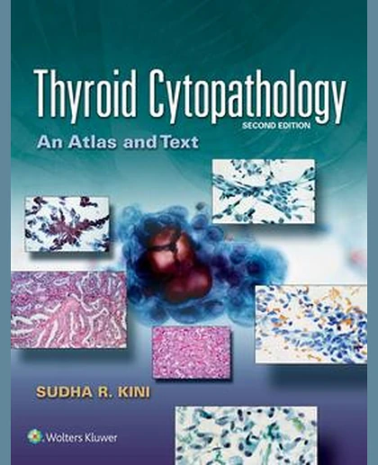 Thyroid Cytopathology