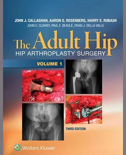 The Adult Hip