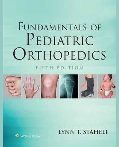 Fundamentals of Pediatric Orthopedics