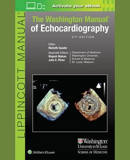 The Washington Manual of Echocardiography