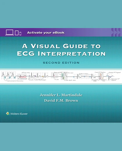 A Visual Guide to ECG Interpretation