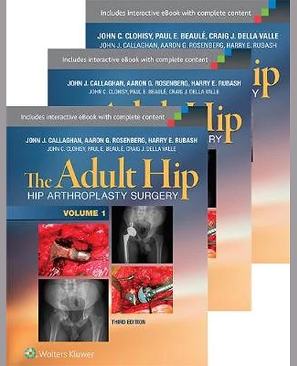 The Adult Hip + the Adult Hip - Hip Preservation Surgery: Arthroplasty and Its Alternatives