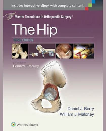 Master Techniques in Orthopaedic Surgery: The Hip