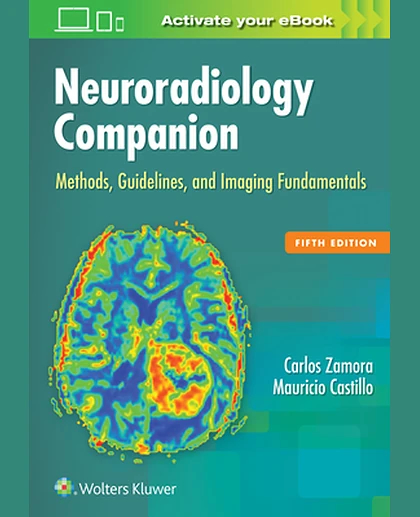 Neuroradiology Companion: Methods, Guidelines, and Imaging Fundamentals