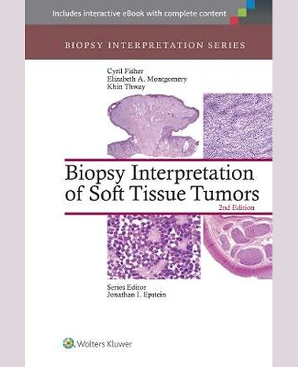 Biopsy Interpretation of Soft Tissue Tumors
