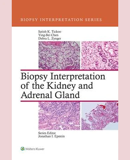 Biopsy Interpretation of the Kidney & Adrenal Gland