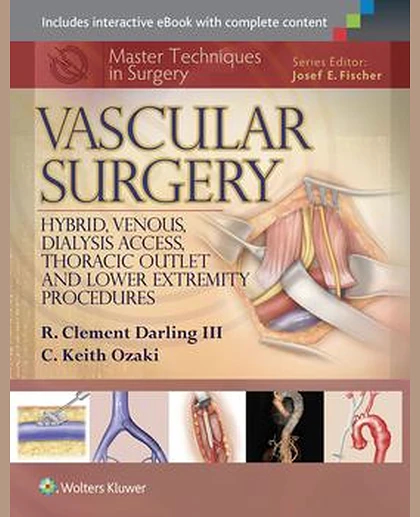 Master Techniques in Surgery: Vascular Surgery: Hybrid, Venous, Dialysis Access, Thoracic Outlet, and Lower Extremity Procedures, 1e