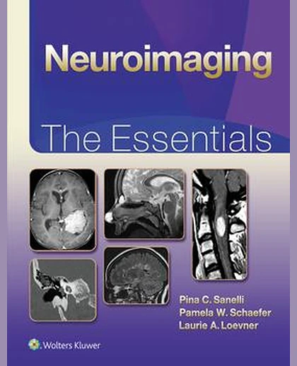 Neuroimaging: The Essentials