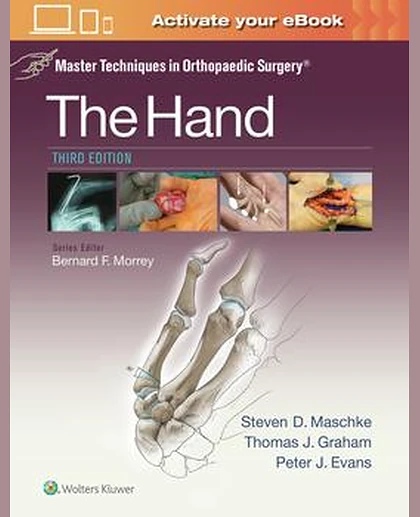 Master Techniques in Orthopaedic Surgery: The Hand