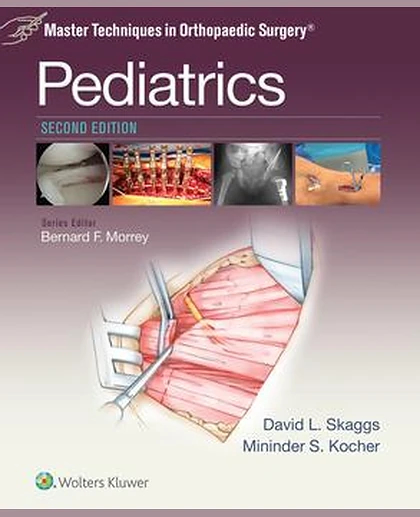 Master Techniques in Orthopaedic Surgery: Pediatrics