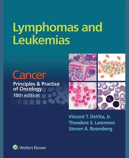 Lymphomas and Leukemias