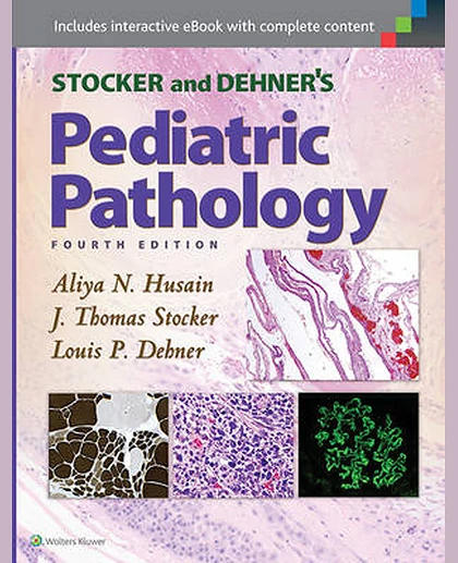 Stocker and Dehner's Pediatric Pathology