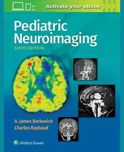 Pediatric Neuroimaging