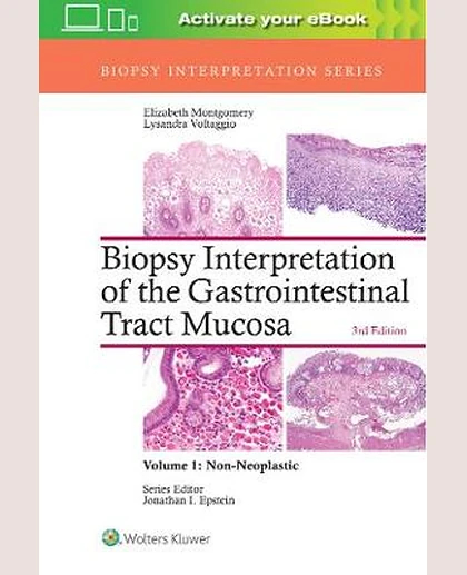 Biopsy Interpretation of the Gastrointestinal Tract Mucosa: , Volume 1