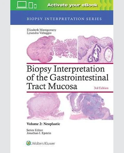 Biopsy Interpretation of the Gastrointestinal Tract Mucosa: Volume 2: Neoplastic: , Volume 2