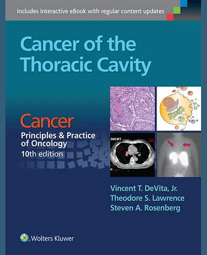 Cancer of the Thoracic Cavity: Cancer: Principles & Practice of Oncology, 10th edition