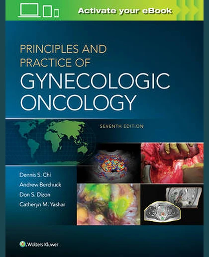 Principles and Practice of Gynecologic Oncology